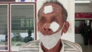 Elderly man injured by driver in buffalo collision dispute