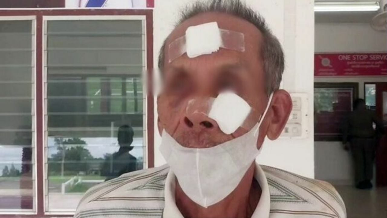 Elderly man injured by driver in buffalo collision dispute