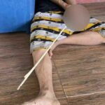 Nakhon Ratchasima student injured in spear gun attack | Thaiger