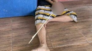 Nakhon Ratchasima student injured in spear gun attack