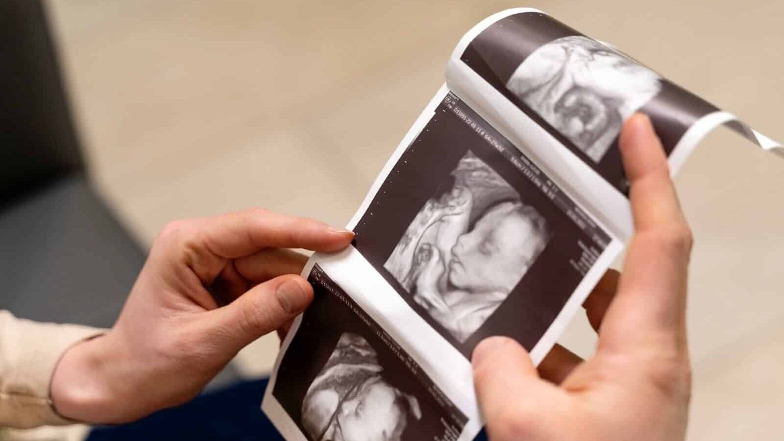 Ultrasound image