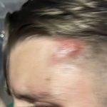 Dutch tourists attacked by foreigners outside Phuket hotel | Thaiger