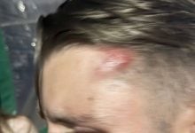Dutch tourists attacked by foreigners outside Phuket hotel | Thaiger