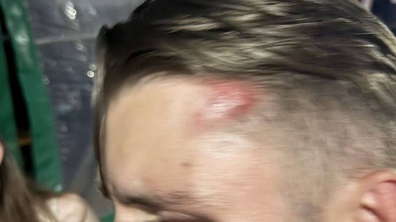 Dutch tourists attacked by foreigners outside Phuket hotel | Thaiger