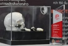 Thailand produces titanium bone implants for wounded soldiers | Thaiger