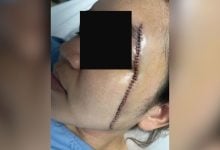 Thai woman suffers 54 stitches after brutal assault by ex-husband | Thaiger