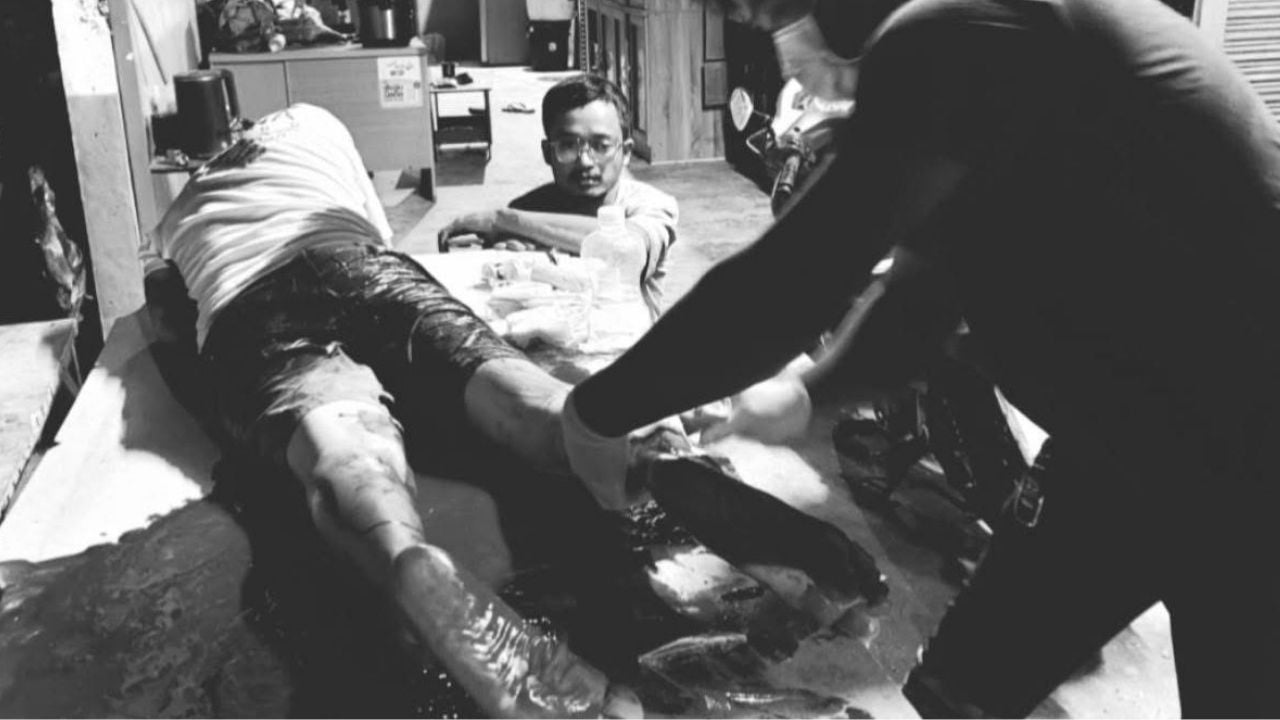 Surin soldiers shot two civilians