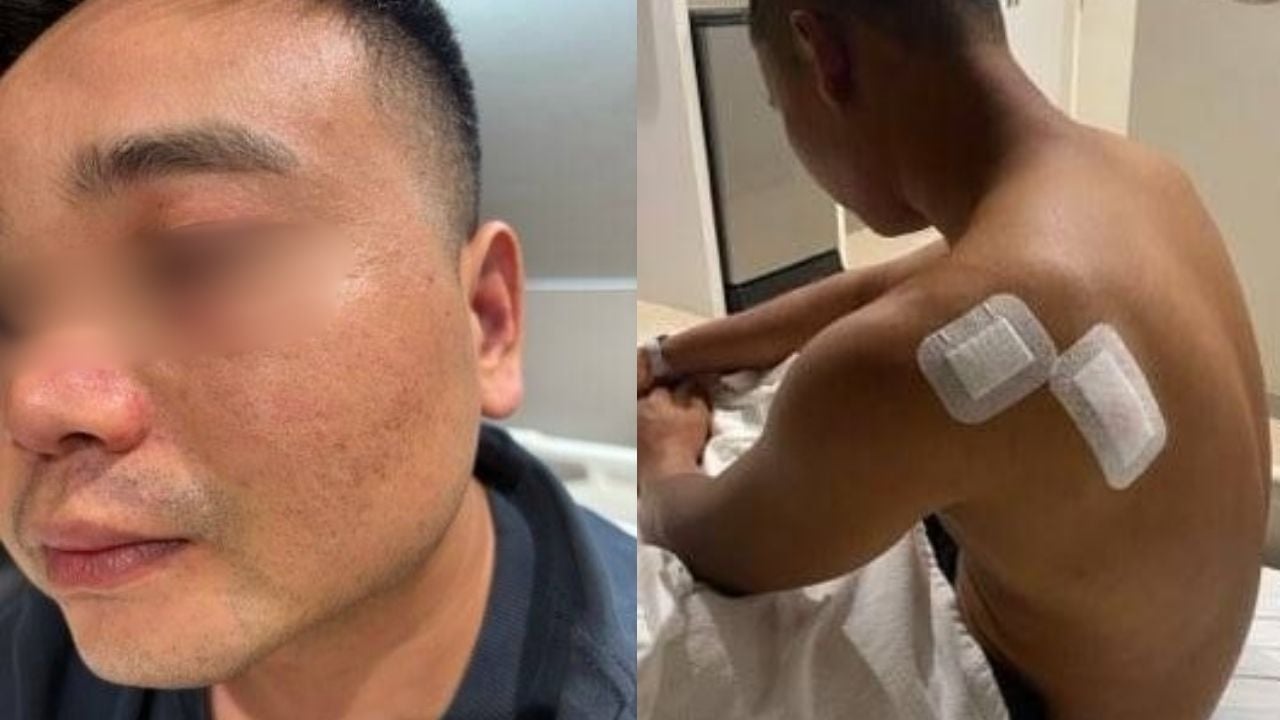 Chinese-born Cambodian man attacked for eating neighbours's crab | News by Thaiger