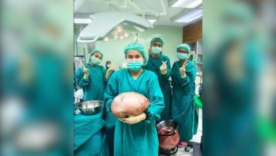 Thai woman’s ‘fat belly’ was 8kg cyst shock | Thaiger