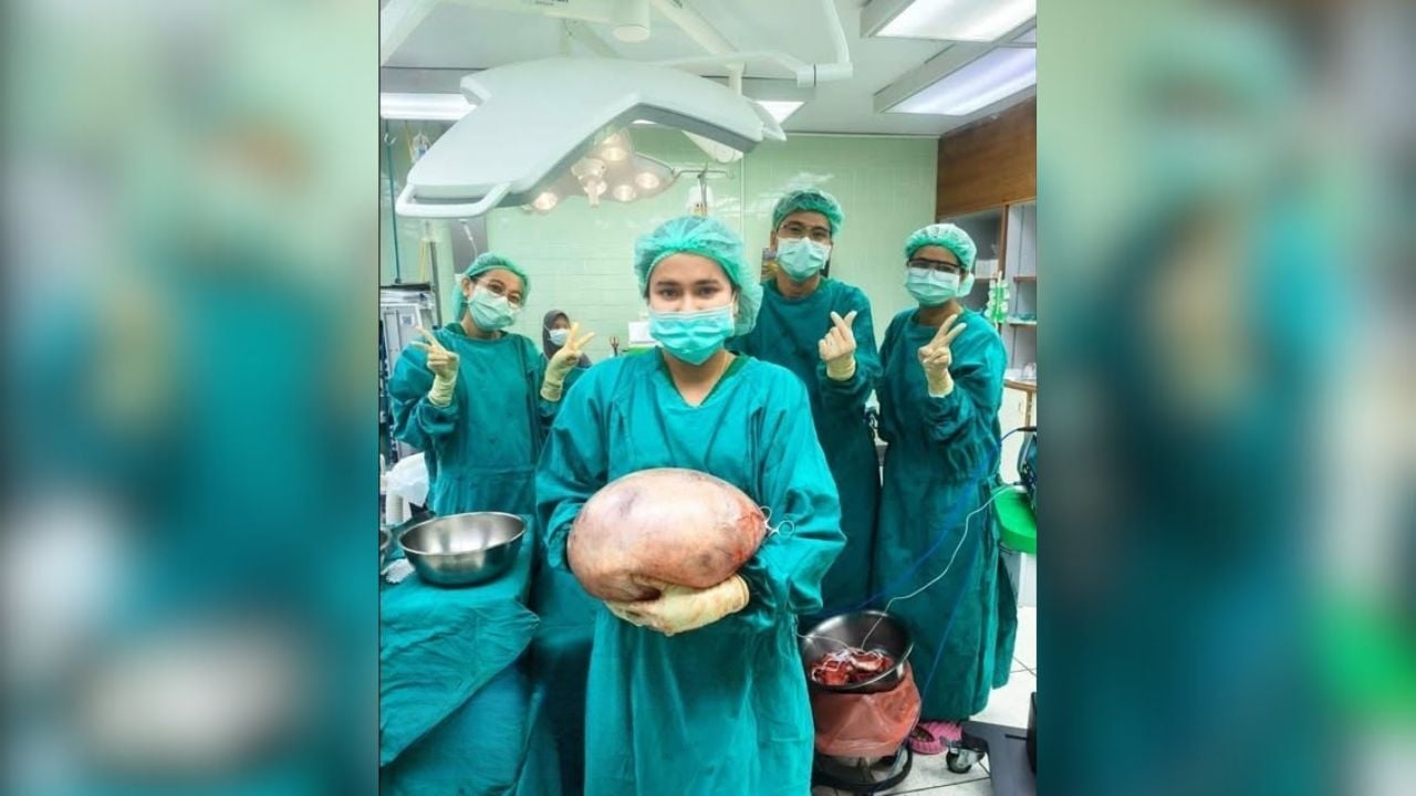 Thai woman’s ‘fat belly’ was 8kg cyst shock | Thaiger