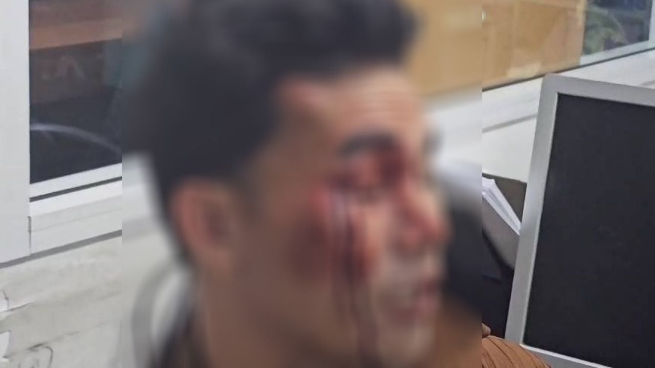 Cambodian man gang attacked for recording sex with young girl in Pattaya | News by Thaiger