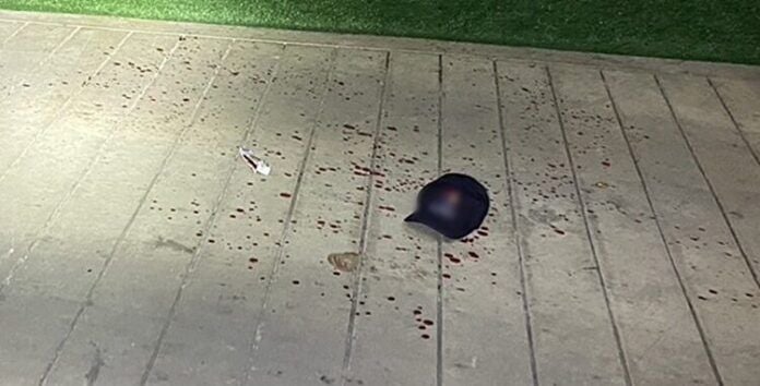 Bangkok condo guard stabbed to death in late-night horror | News by Thaiger