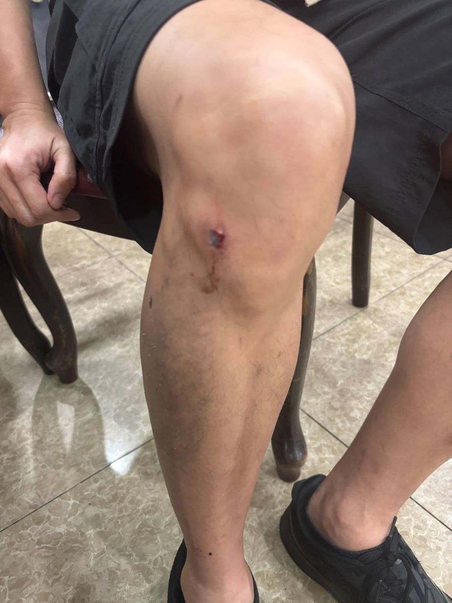 American tourist knocked out in late-night Pattaya clash | News by Thaiger