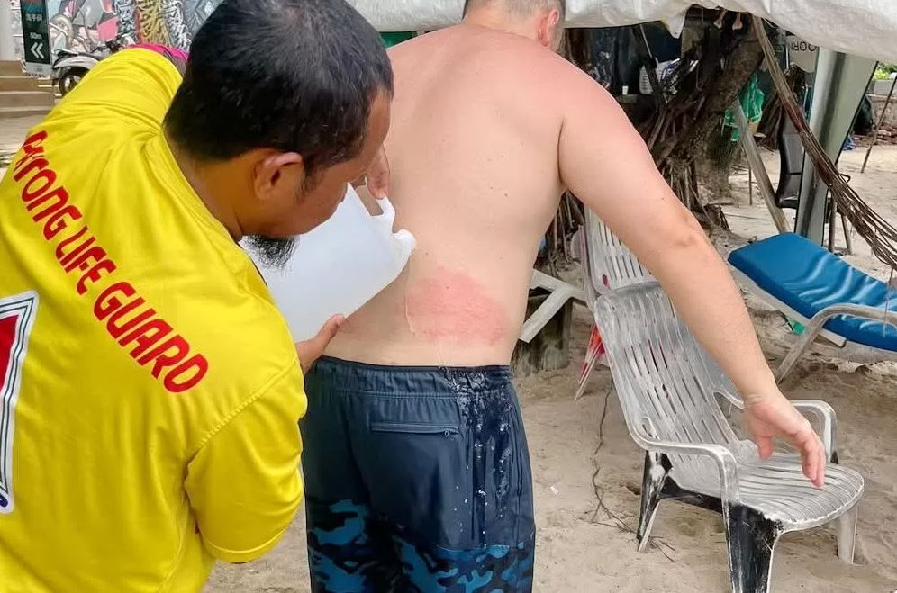 Box jellyfish sting scare hits tourists at Patong Beach | News by Thaiger