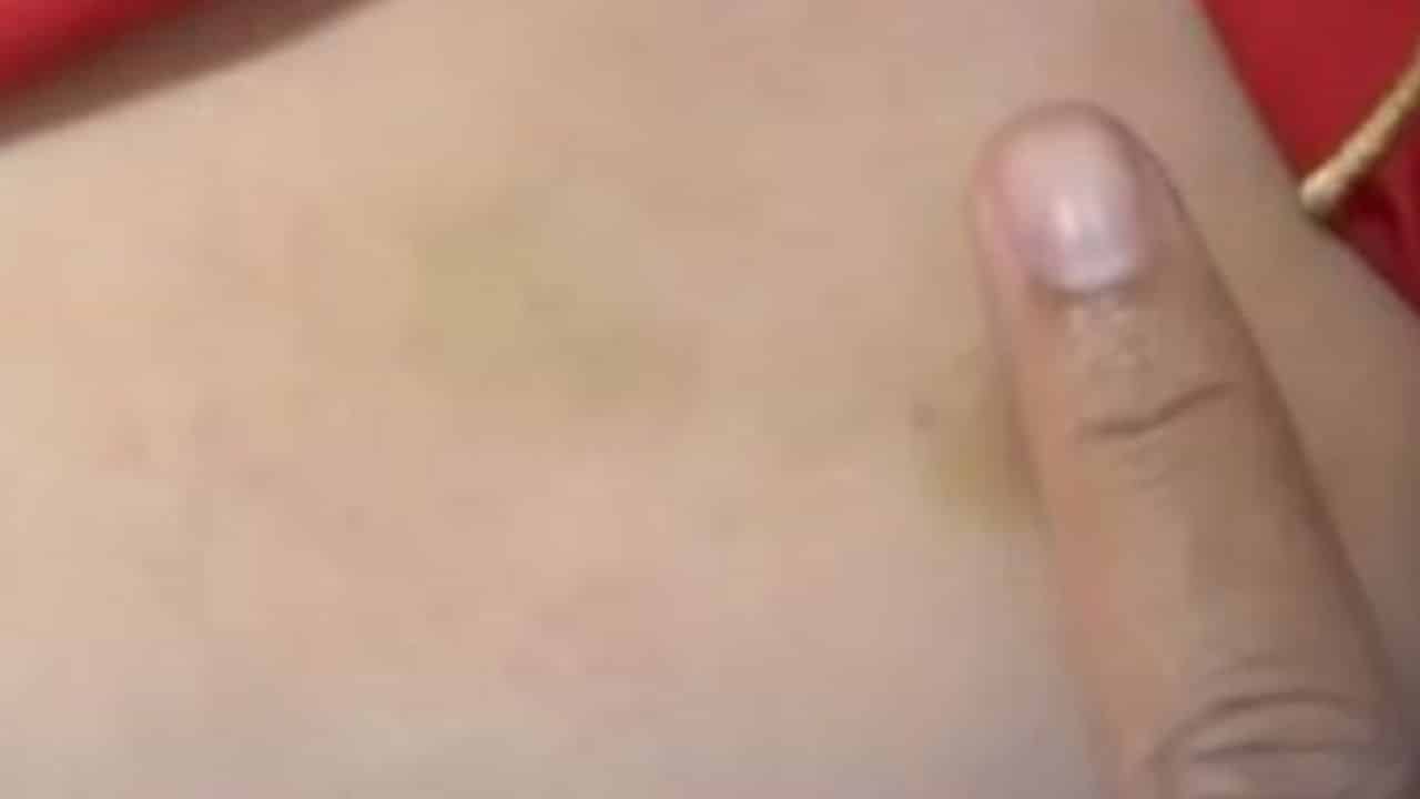 Thai boy abused by father