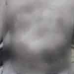 Chon Buri doctor allegedly pours hot water over 3 year old boy during treatment | Thaiger