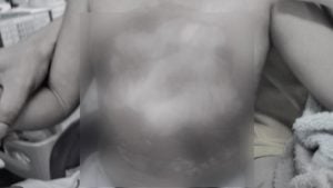 Chon Buri doctor allegedly pours hot water over 3 year old boy during treatment | Thaiger