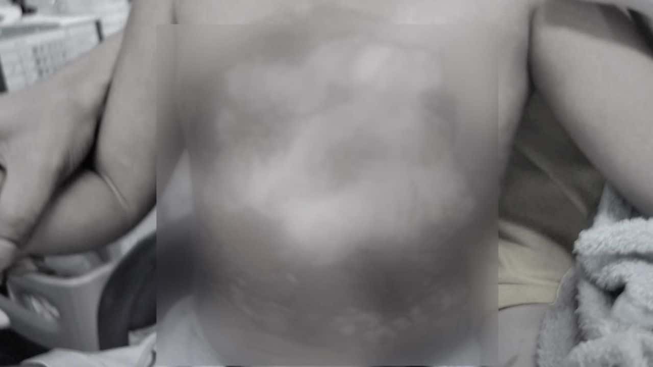 Chon Buri doctor allegedly pours hot water over 3 year old boy during treatment | Thaiger