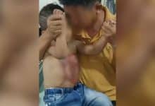 Chon Buri clinic closed temporarily after hot water treatment on 3 year old boy | Thaiger