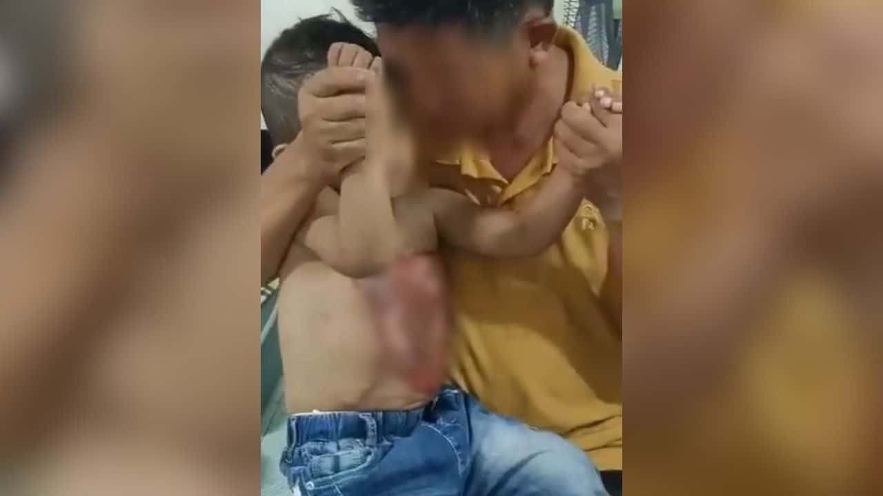 Chon Buri clinic closed temporarily after hot water treatment on 3 year old boy | Thaiger