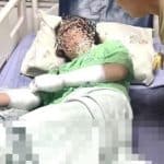 Employer pours boiling water on worker over romance with her brother | Thaiger