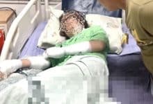 Employer pours boiling water on worker over romance with her brother | Thaiger