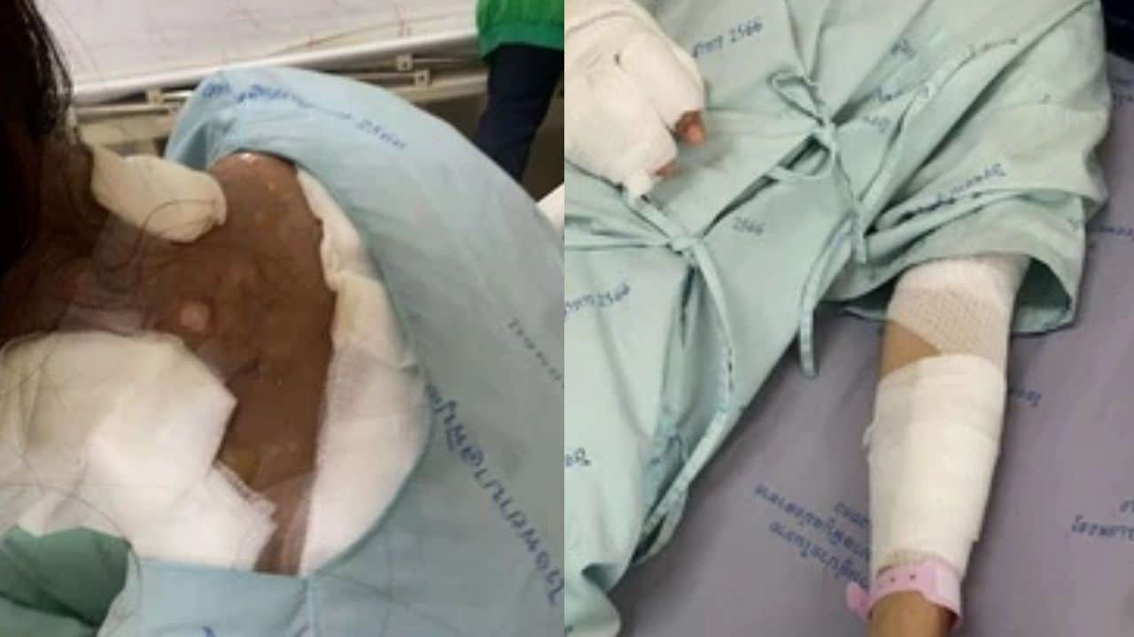 Woman attacked by boyfriend's sister