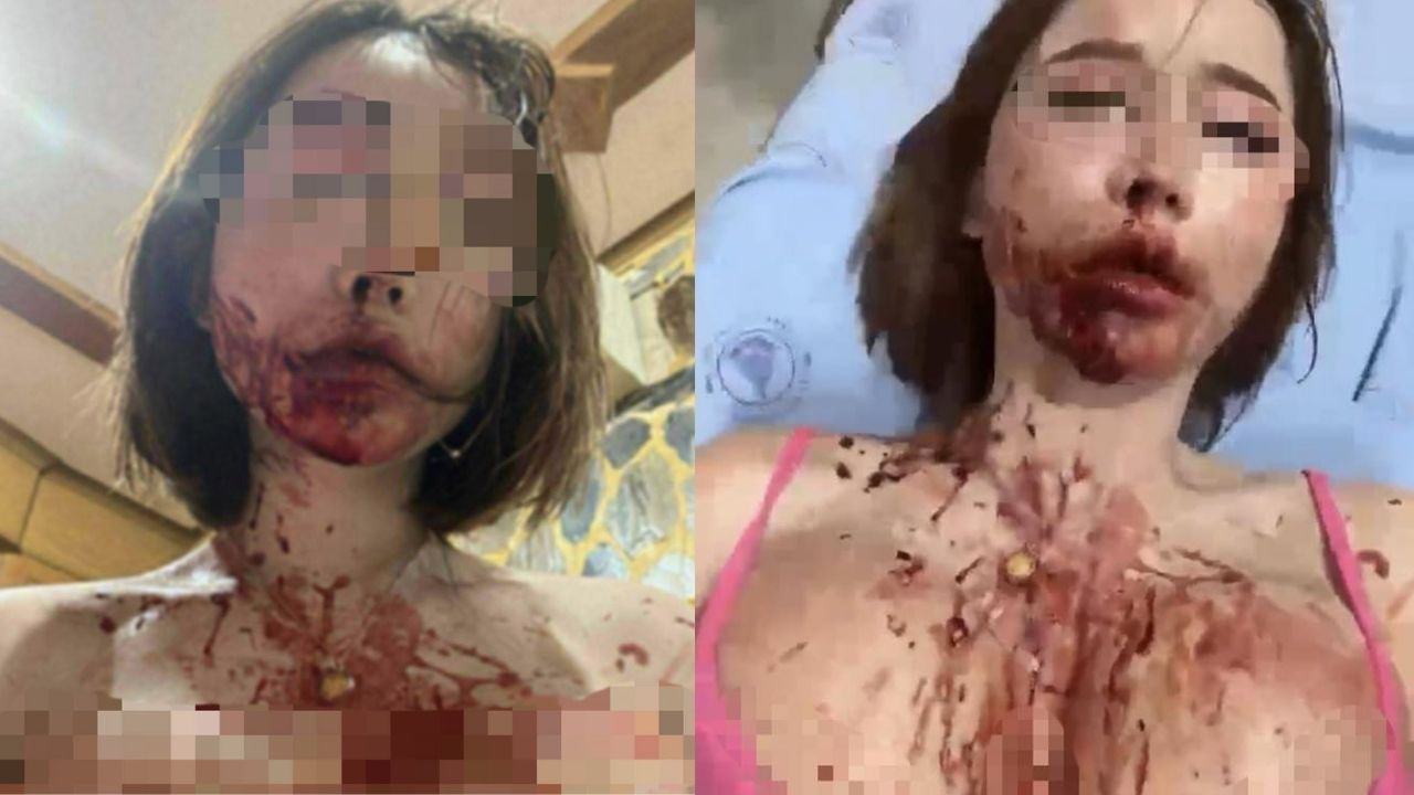 Thai transwoman robbed by Indian man met on dating app
