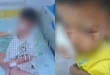 Thai boy hospitalised after buffalo attack at Buriram home | Thaiger