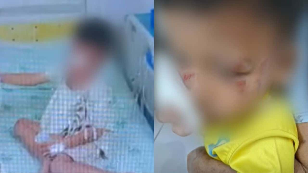 Thai boy hospitalised after buffalo attack at Buriram home | Thaiger