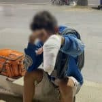 Pattaya teen badly hurt after firecracker explodes on beach | Thaiger