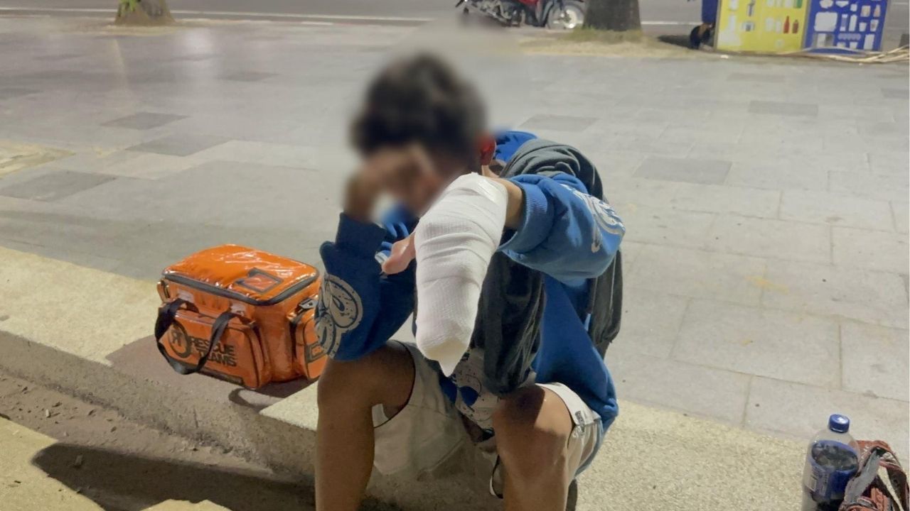 Pattaya teen badly hurt after firecracker explodes on beach | Thaiger