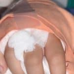 Chiang Mai teen’s hand reattached after gang attack | Thaiger