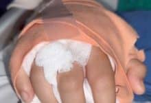 Chiang Mai teen’s hand reattached after gang attack | Thaiger