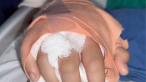 Chiang Mai teen’s hand reattached after gang attack | Thaiger