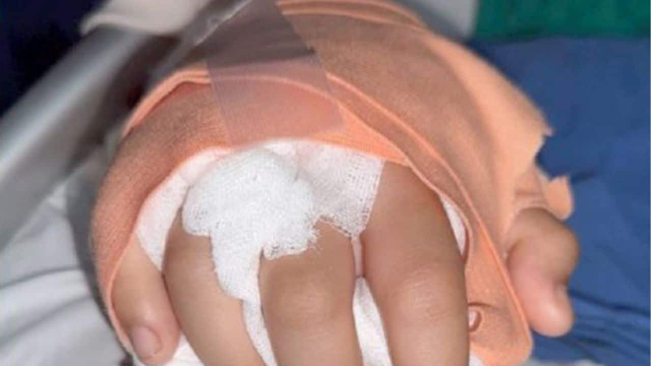 Chiang Mai teen’s hand reattached after gang attack | Thaiger