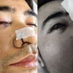 Thai man left blind after surgery at private hospital in Samut Sakhon | Thaiger