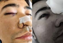 Thai man left blind after surgery at private hospital in Samut Sakhon | Thaiger