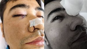 Thai man left blind after surgery at private hospital in Samut Sakhon | Thaiger