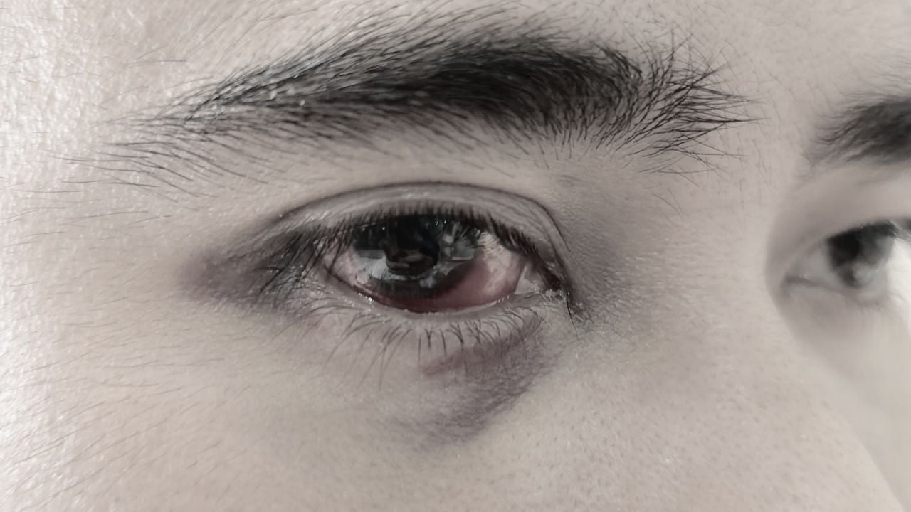 Thai man becomes blind after treatment at private hosptial