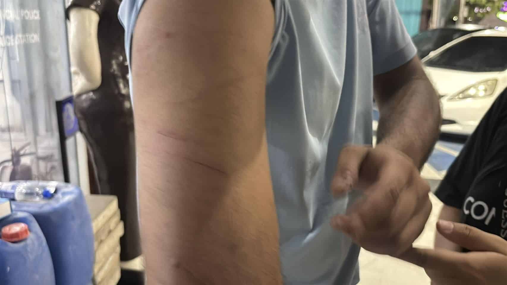 Pakistani DJ attacked by motorcycle gang in Pattaya | News by Thaiger