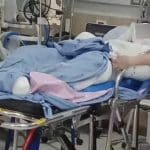 Thai boy suffers severe burns helping teacher burn wasp hive | Thaiger