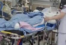 Thai boy suffers severe burns helping teacher burn wasp hive | Thaiger