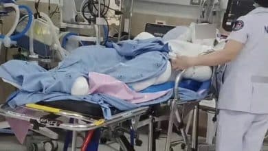 Thai boy suffers severe burns helping teacher burn wasp hive | Thaiger