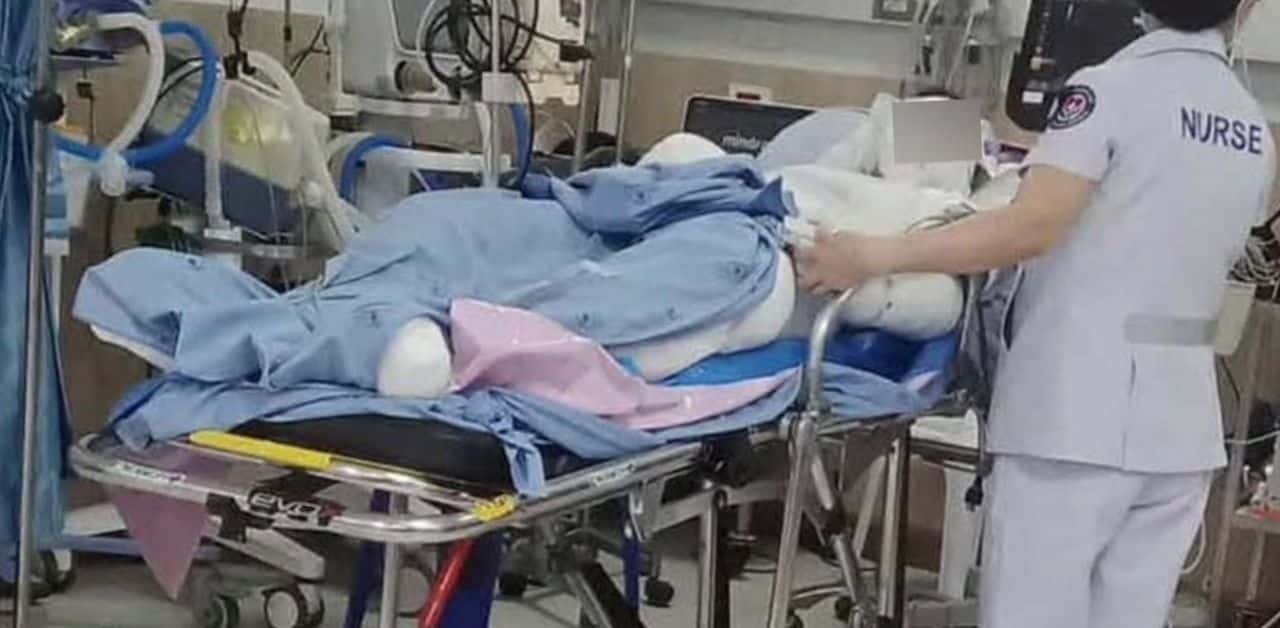 Thai boy suffers severe burns helping teacher burn wasp hive | Thaiger