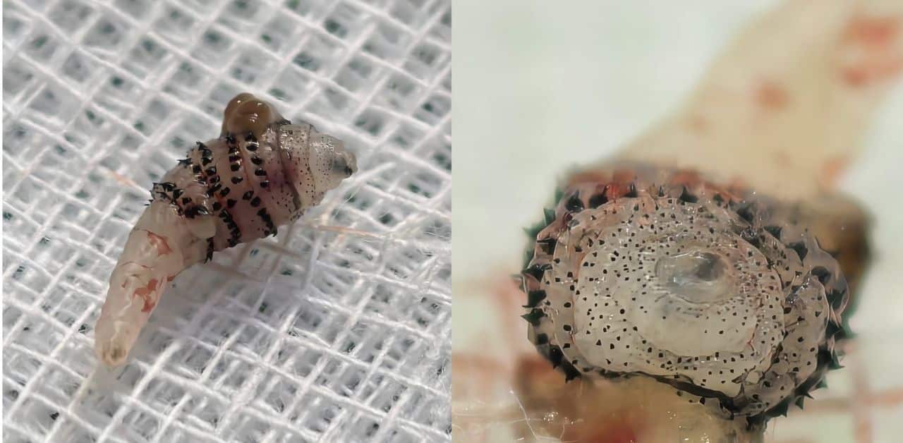 Larva found on foreign man sparking panic