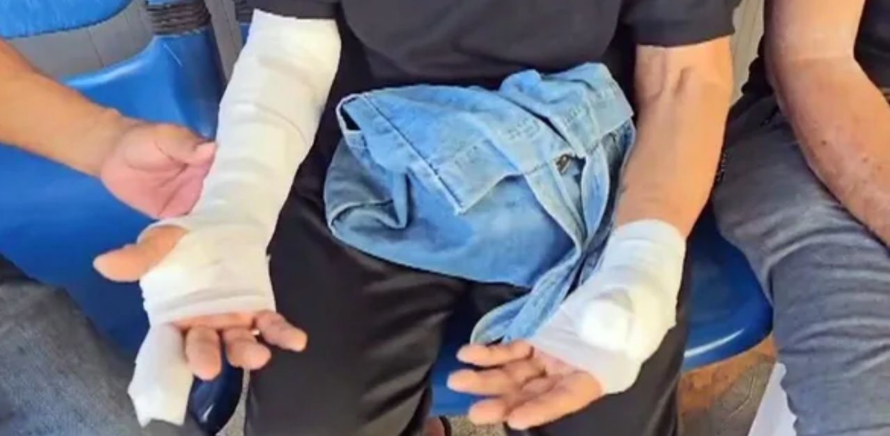 wild cat attack in Saraburi