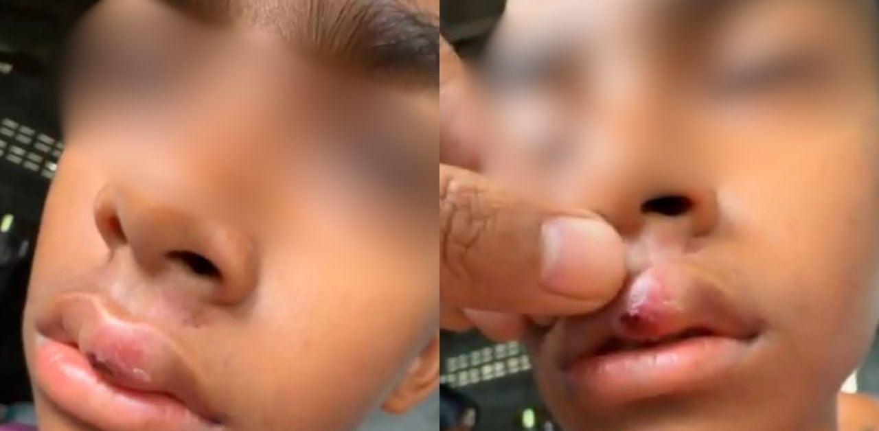 School billies leads man to attack brother's rival