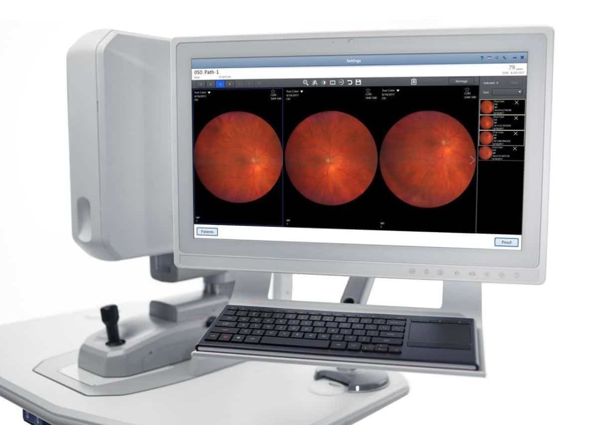 diagnosing Diabetic Retinopathy
