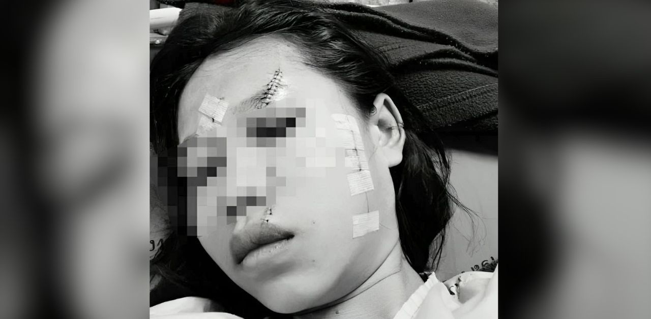 Thai girl attacked by classmate